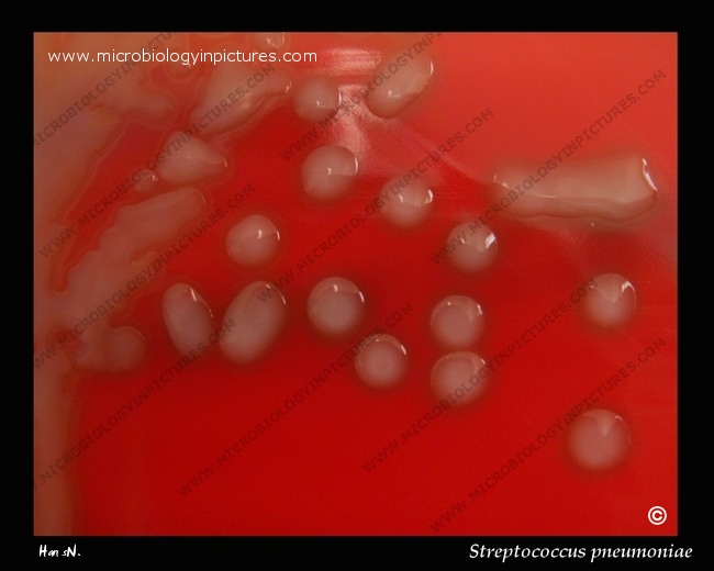 encapsulated, mucoid S.pneumoniae colony morphology